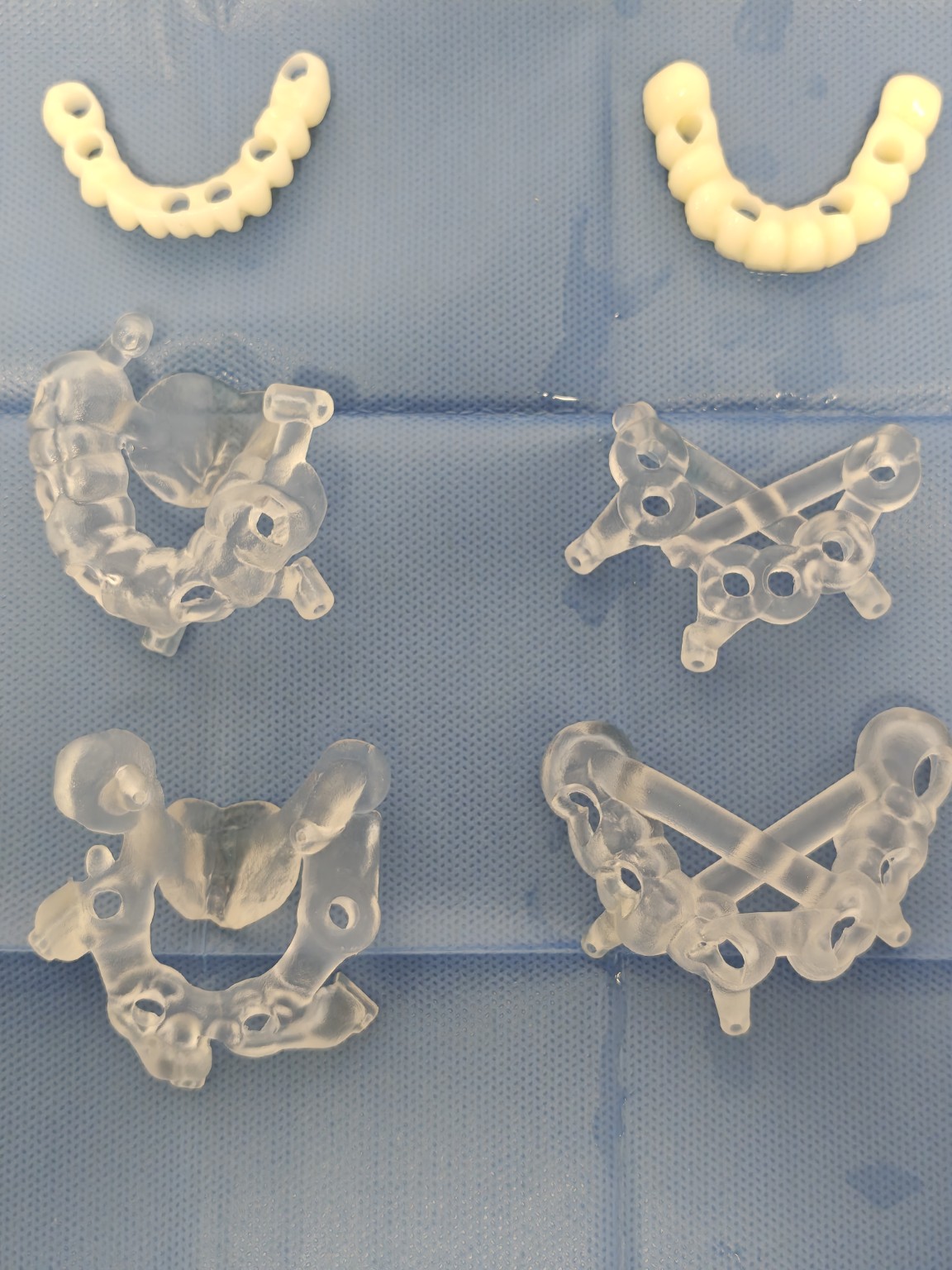 Chirurgie ghidată și dinți ficși