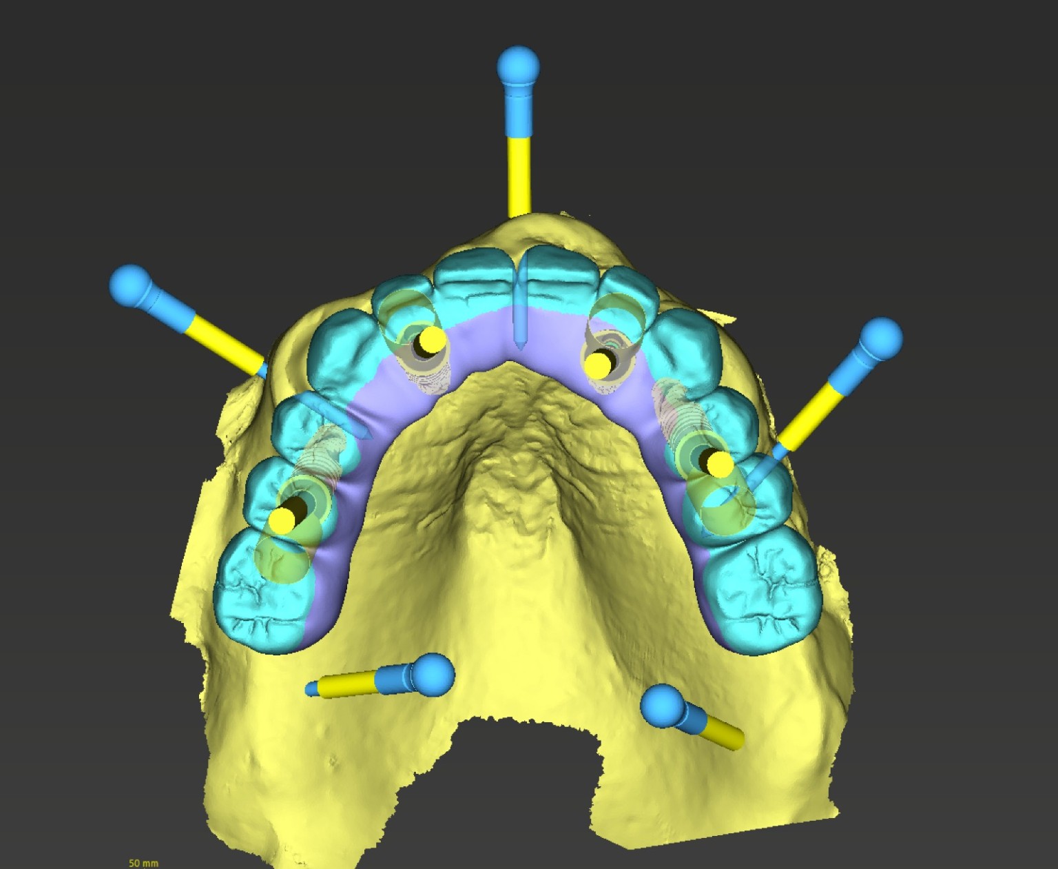 Planificare ghidată